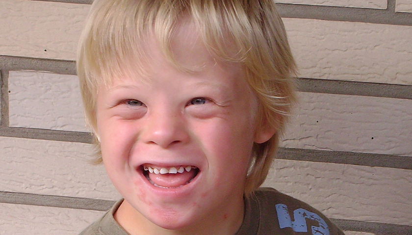 Young blonde boy with down syndrome
